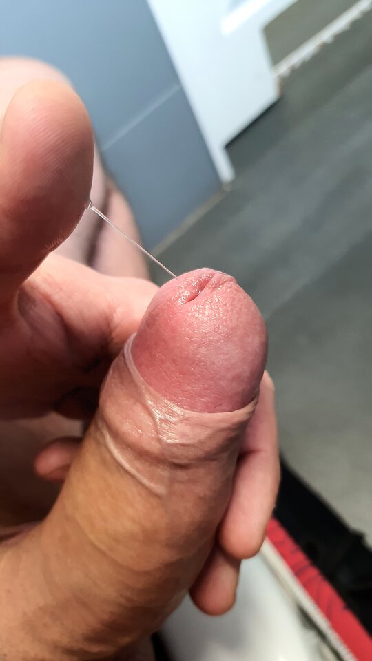 1000032267.jpg - toxict