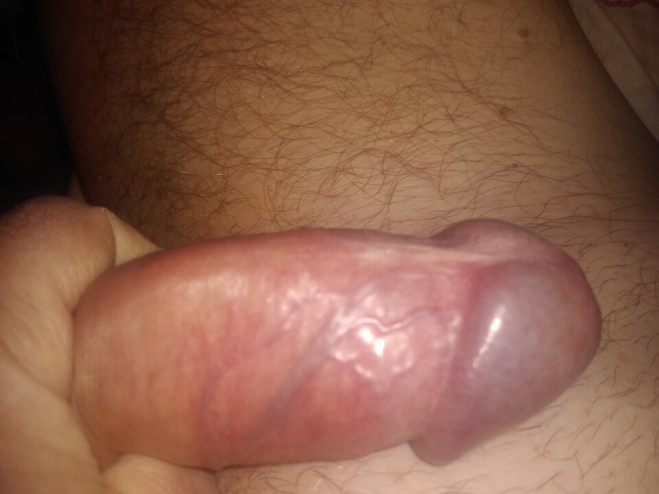 17110524046595609150425574116205.jpg - twoeyes