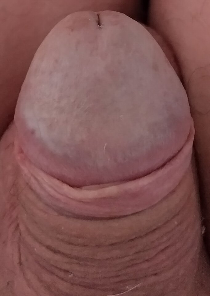 1000001720.jpg - endzik