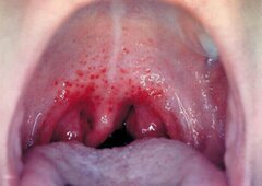 CHORE GARDŁO (29.7 x 21 cm).jpg