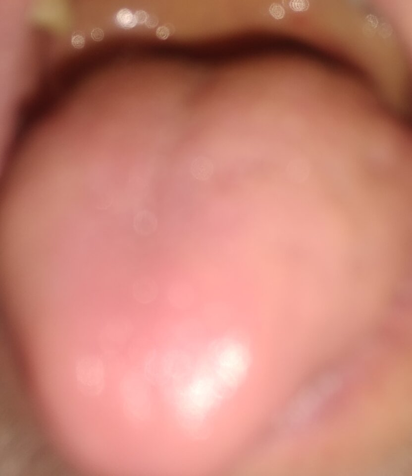 IMG_20240406_160935892.jpg - twoeyes