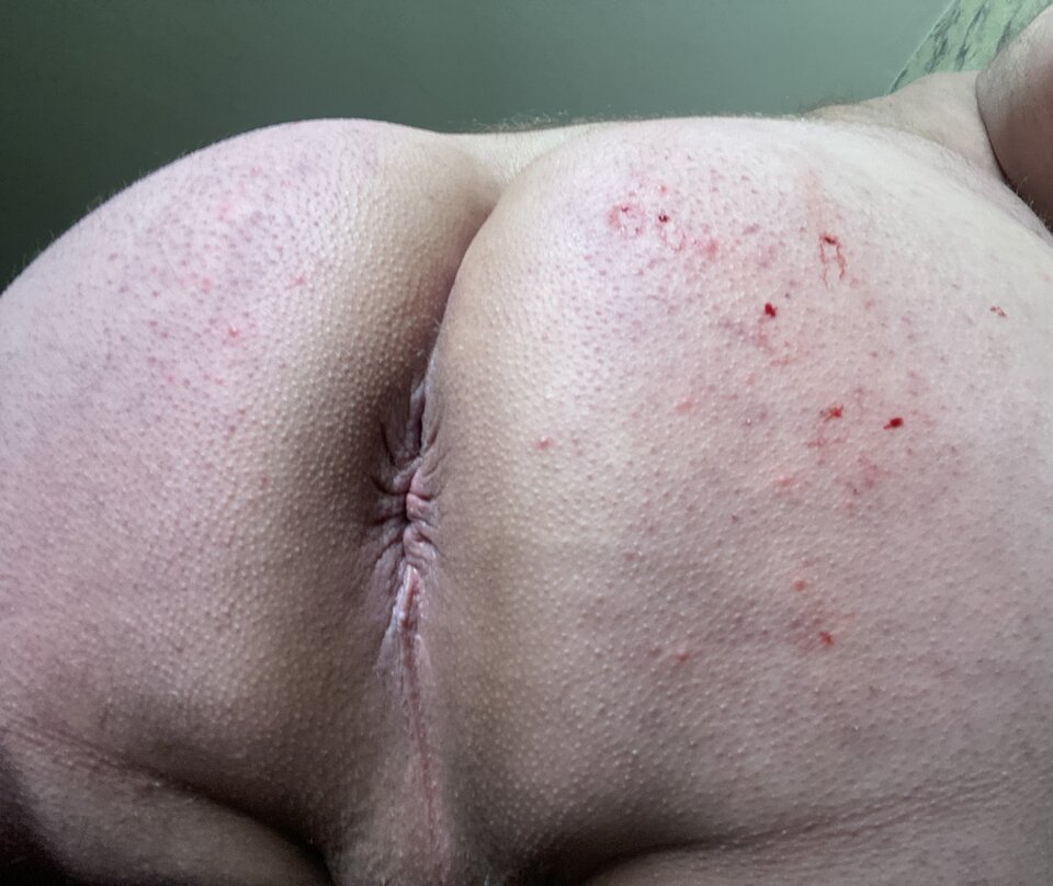 CA93E2EC-EAA7-4056-813D-FD89C4DD6A7B.jpeg - sENDs