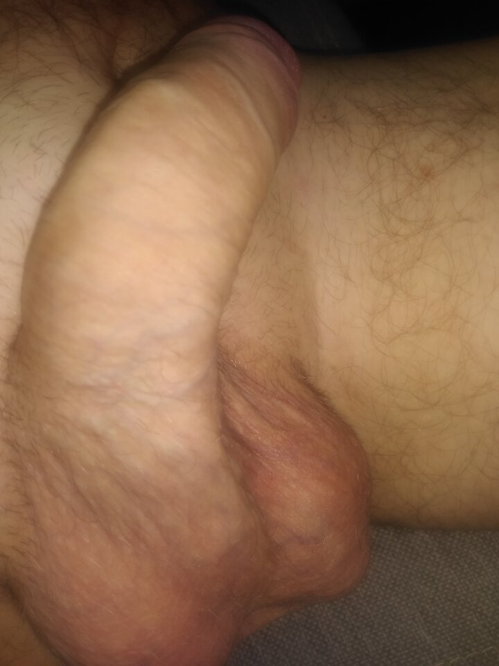 17126677615745658861281265499543.jpg - twoeyes