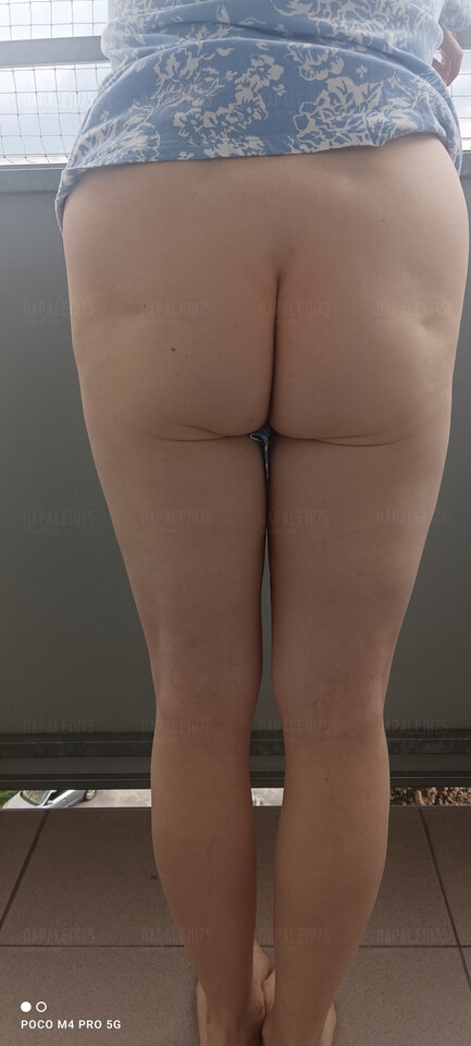 IMG_20240414_171647.jpg - Napaleni75