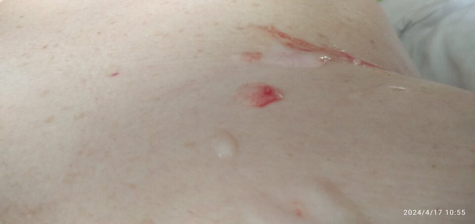 Krew i sperma - Ajsza69