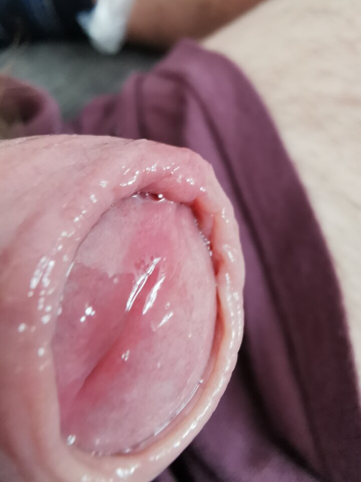 IMG_20240419_101210.jpg - Zi0001