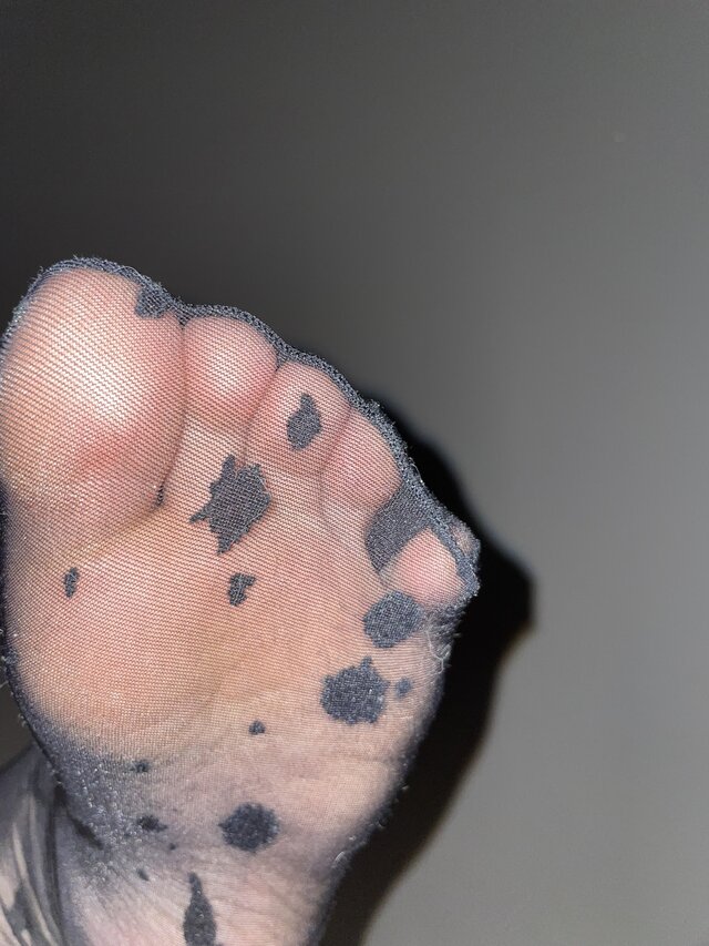 Malfeet