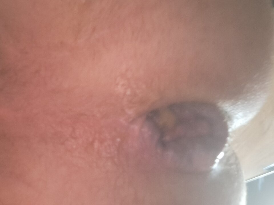 1000022055.jpg - rafal1410