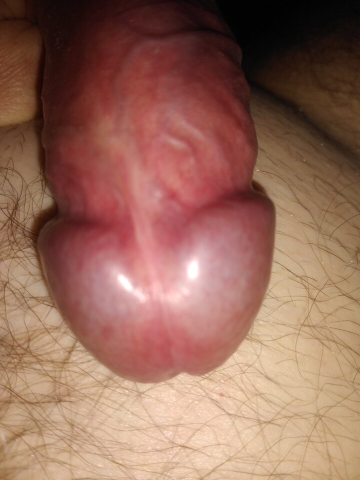 17167059900668164383794866189712.jpg - twoeyes