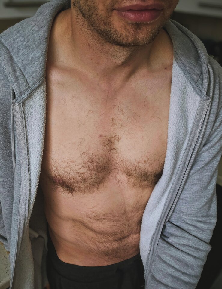 😇👄 - onkrak20
