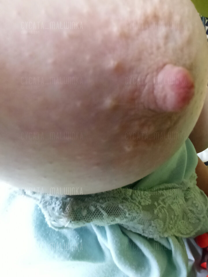 :)) - cycata_malwinka