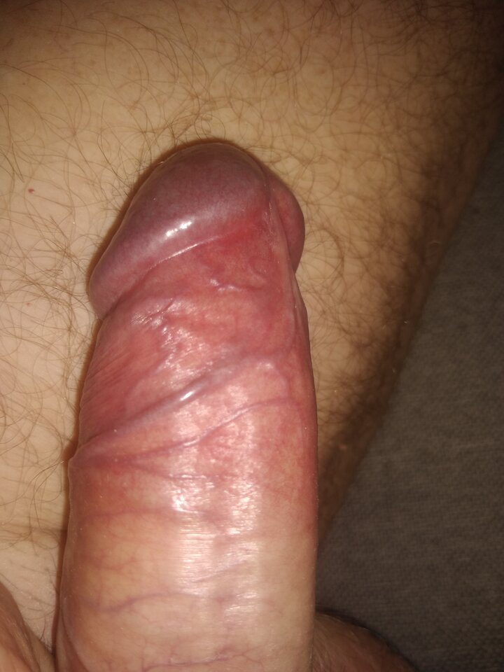 17197613184808069624480799502180.jpg - twoeyes