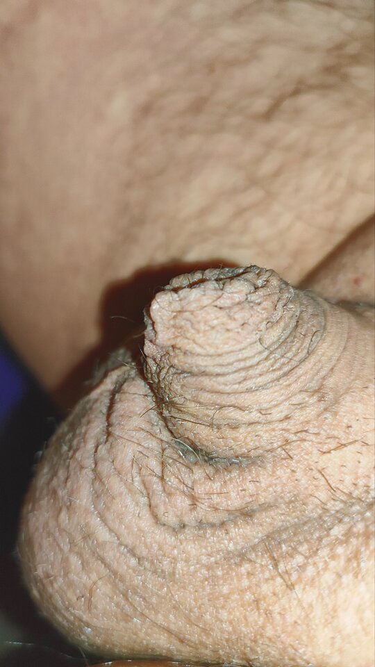 1000008793.jpg - stopkaZkundlem