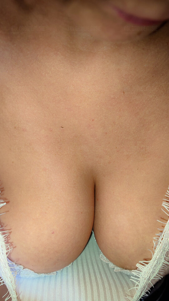 P40710_091520.jpg - kolorowemisie