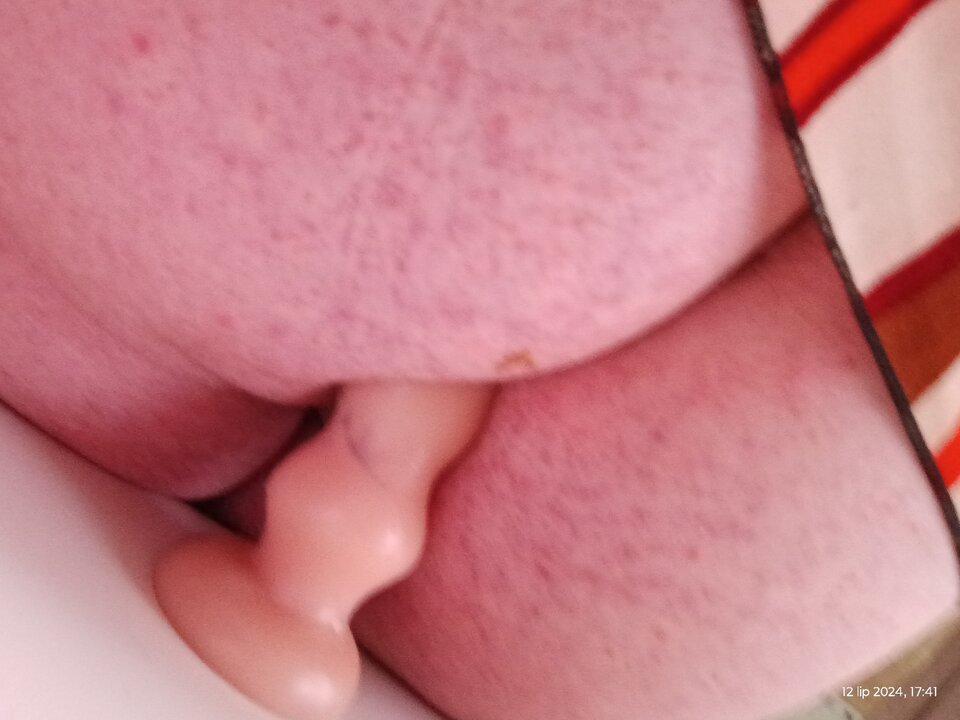 1720798892597319810025463766156.jpg - Palciusia