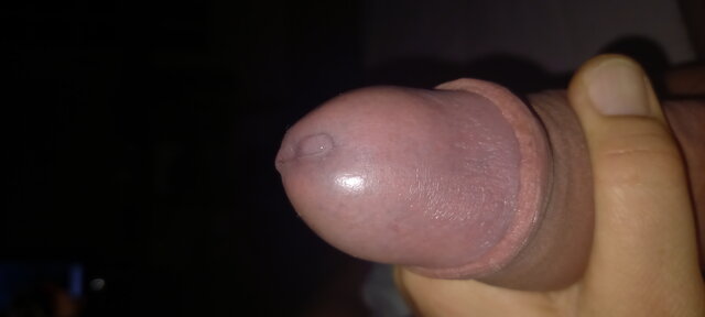 skolimus