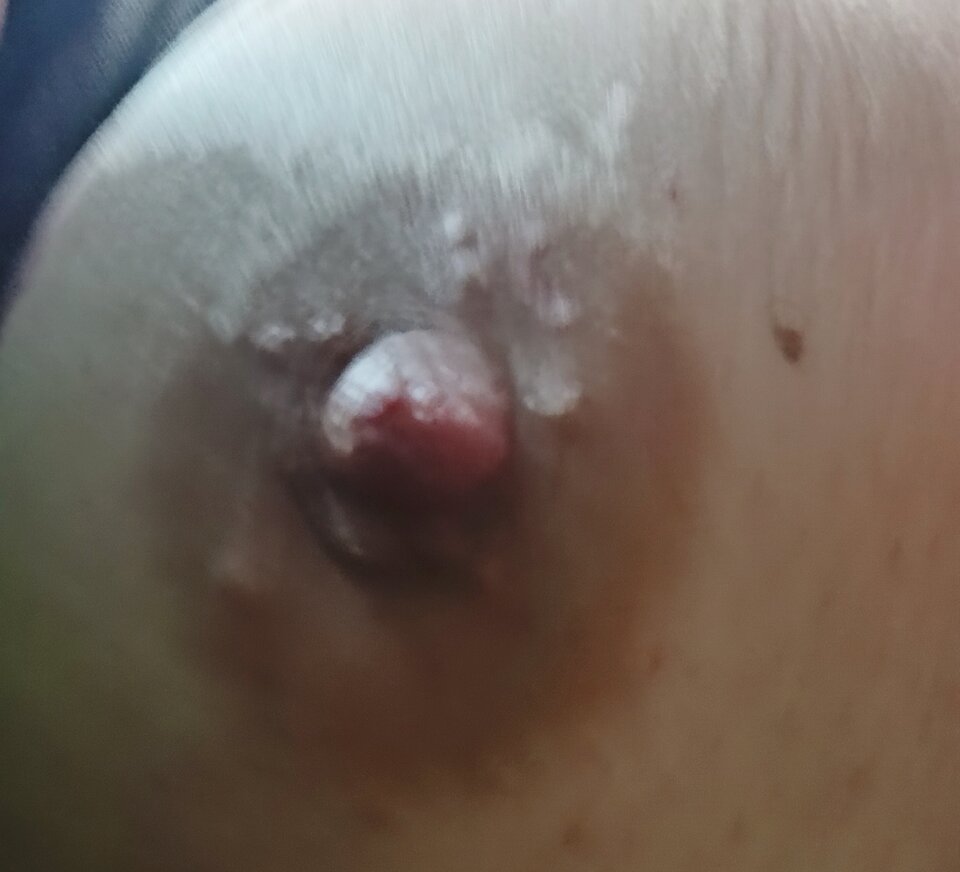 Guziczek - pareczka123