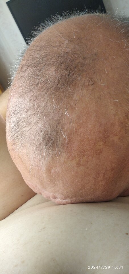 IMG_20240729_163121.jpg - Ajsza69