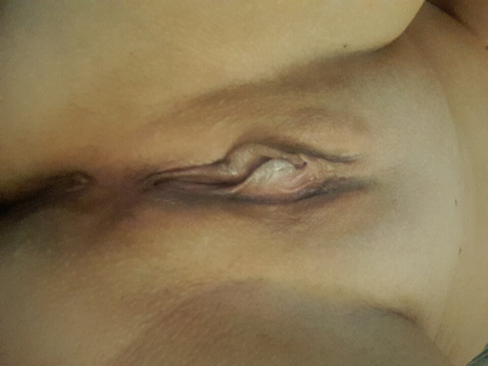 20240807_075006.jpg - ParkaOlsztyn15