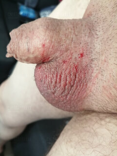 zla wybrana maszynka do golenia