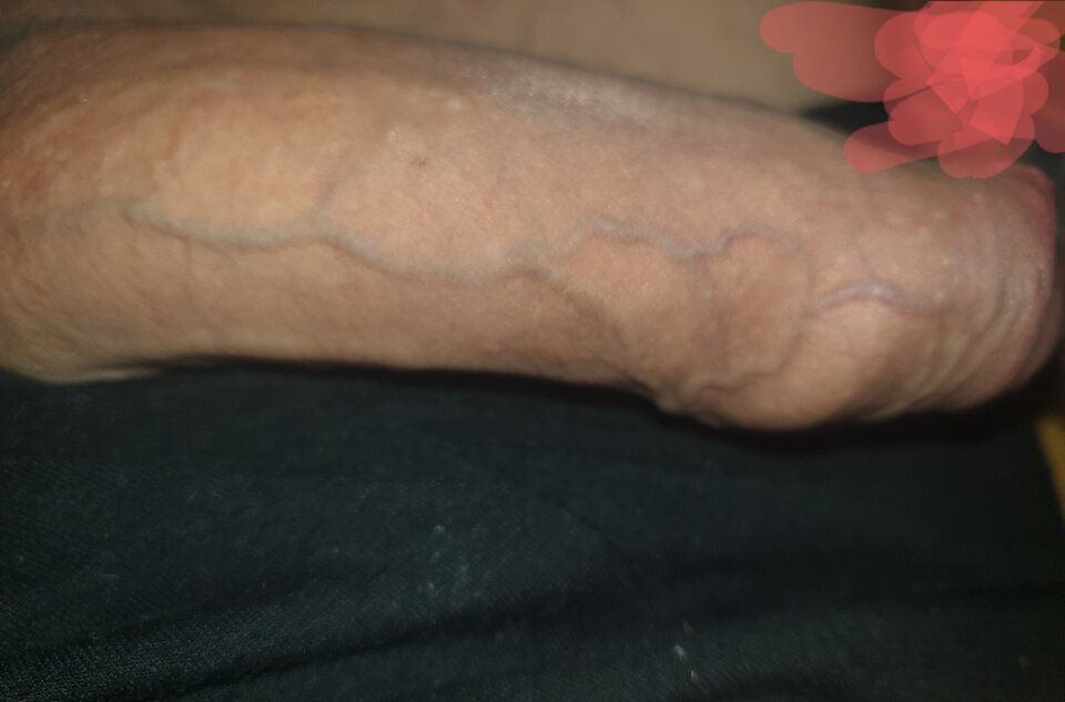 20240811_052600.jpg - ParaParasex