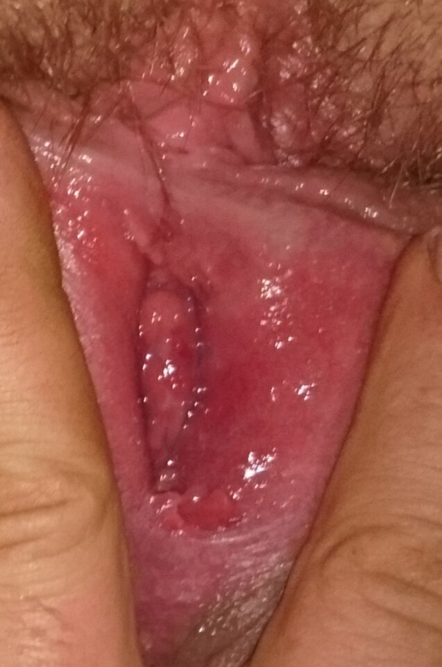 Wilgoć cipeczki - Agibagi2022