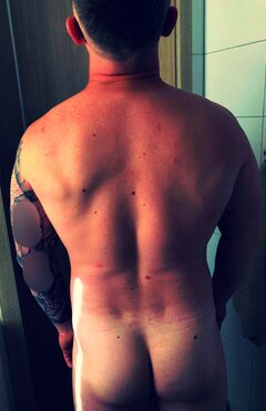 Plecki na każdy problem