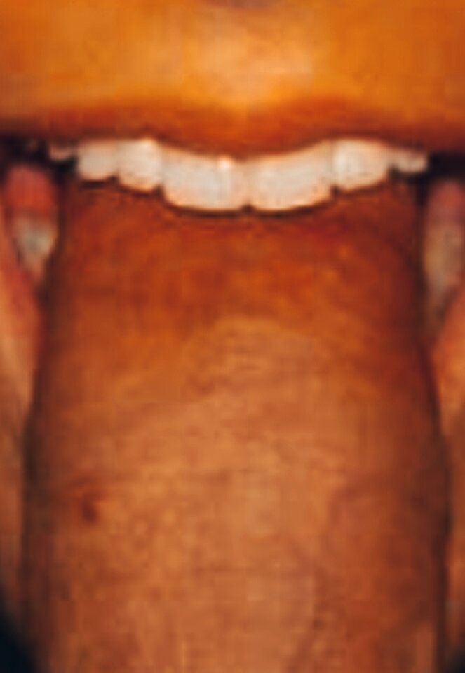 IMG_20240824_183339.jpg - BiLodziarz