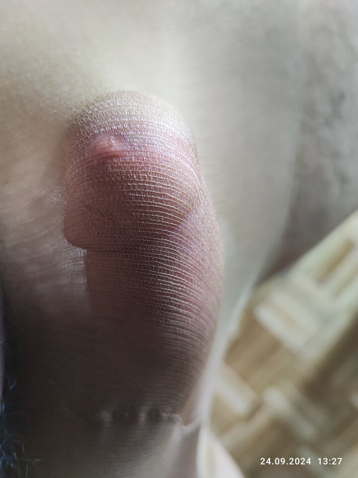 1000047256.jpg - fetysz84